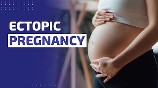 ECTOPIC PREGNANCY  OVERVIEW PATHOPHYSIOLOGY SIGNS AND SYMPTOMS TREATMENT INVESTIGATIONS [upl. by Shoifet]