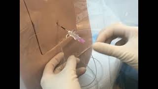 Neuraxial Task Trainer Demonstration  Epidural Anesthesia [upl. by Aynod]