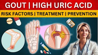 GOUT  TREATMENT  PROPHYLAXIS  RISK  SYMPTOMS  PATHOPHYSIOLOGY  URIC ACID [upl. by Costello]