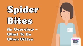 Spider Bites  An Overview – What To Do When Bitten [upl. by Solly560]