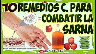 10 Remedios Caseros y Naturales para la Sarna COMO CURAR LA SARNA HUMANA [upl. by Hitchcock]