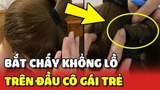 Cô gái bị ngứa đầu ai dè bắt được con quotCHẤY KHỔNG LỒquot và cái kết hú hồn 😮  Yêu Lu [upl. by Steele]