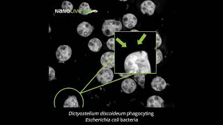 Amoeba defeats Escherichia coli bacteria [upl. by Ellecrag54]