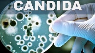 Secretos caseros para la cándida – Como combatir la candidiasis de manera natural [upl. by Htidirem374]