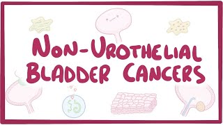 Nonurothelial cell bladder cancers  causes symptoms diagnosis treatment pathology [upl. by Aron]