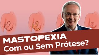 Tudo sobre Mastopexia com ou sem prótese [upl. by Akinak767]