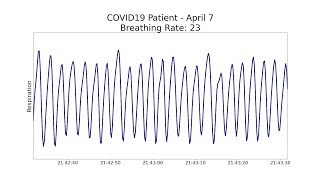 Noncontact health monitoring for COVID19 [upl. by Aynotak283]