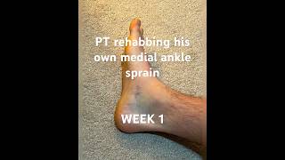 Physical Therapist rehabbing his own deltoid ligament sprain  Week 1 anklerehab anklesprain [upl. by Sidell]