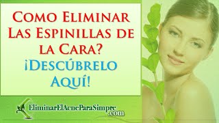 Como Eliminar Las Espinillas de la Cara ¡Descubrelo Aquí [upl. by Dunkin598]