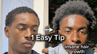 How To Grow Hair Quickly With This 1 Secret Tip [upl. by Eanrahc]