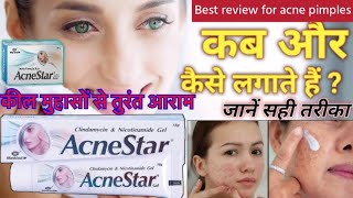 Acnestar gel for acne pimples कील मुंहासों से तुरंत आराम असरदार दवाई youtubeviralvideo ytvideo [upl. by Kreindler593]