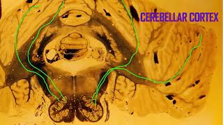 Purkinje cells in the cerebellum [upl. by Ravens662]