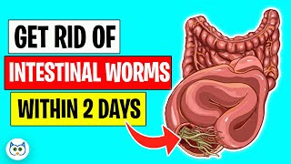 Use These Natural Methods To Get Rid of Intestinal Worms Within Two Days [upl. by Gonzalez153]