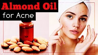 This is How to Use Almond Oil for Acne and Scars [upl. by Eluj967]