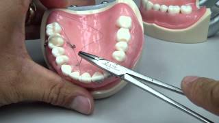 Root Coverage  Sling Suture [upl. by Eimyaj]