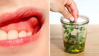 Heal Your Tooth Abscess  Dental Infection Naturally [upl. by Olive114]