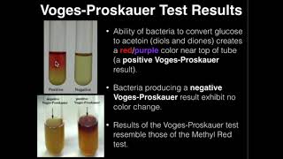 Microbiology VogesProskauer Test [upl. by Maccarone203]