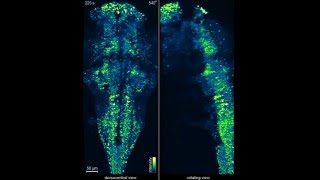 IsoView Wholebrain functional imaging in larval zebrafish [upl. by Nethsa]