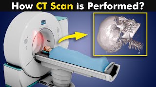 What is CT Scan  How CT Scan Is Performed UrduHindi [upl. by Ailev]