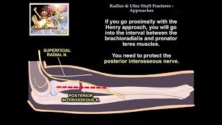 Comparative anatomy of the Radius and ulna [upl. by Enerehs729]