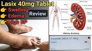 lasix 40 mg tablet uses in hindi  lasix tablet uses in hindi  edema treatment [upl. by Tohcnarf]