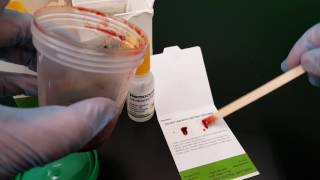 Microbiology Fecal Occult Blood [upl. by Okoy]