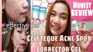 CELETEQUE ACNE SPOT CORRECTOR GEL  Honest Review  Daytoday update [upl. by Coppola]