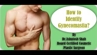 How to Identify Gynecomastia Gynecomastia Information by Dr Ashutosh Shah Surat Gujarat India [upl. by Eerat]