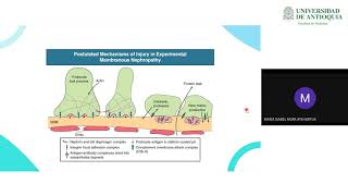 Caso Clínico Glomerulonefritis Membranosa  Dra María Isabel Mora [upl. by Marron]