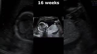 536 Weeks Embryo To Fetus Appearance On Ultrasound  Dr Sams Imaging Library shorts [upl. by Ellehsram]