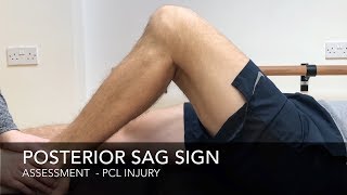 Posterior Sag Sign [upl. by Nitin]