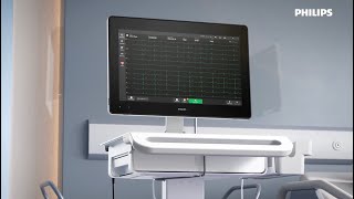 Philips Cardiac Workstation — Tap the power of connected cardiography [upl. by Fronniah798]