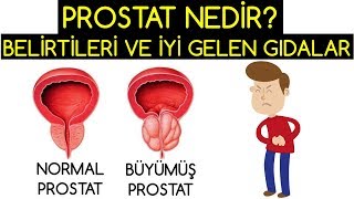 PROSTAT NEDİR BELİRTİLERİ VE TEDAVİ EDEN GIDALAR [upl. by Yetnruoc862]