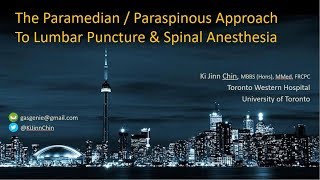 Paraspinous  Paramedian Approach to Lumbar Puncture  Spinal Anesthesia [upl. by Arykahs]