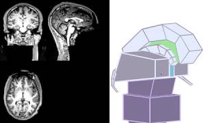 MRI  3D Brain Anatomy Hypothalamus Pituitary Gland Fornix Corpus Callosum amp 3rd Ventricle [upl. by Syhr]