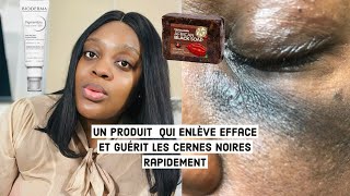 COMMENT ENLEVER  ÉCLAIRCIR ET FAIRE DISPARAÎTRE LES CERNES NOIRS RAPIDEMENT  Angele DE GIDES [upl. by Ynalem877]