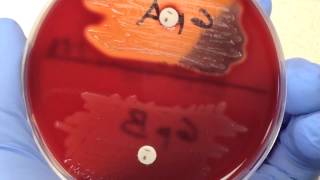 Microbiology  Bacitracin [upl. by Strain]