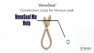 Venoseal Short [upl. by Winonah]