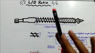 LD ratio of injection moulding machine screw [upl. by Tymes977]