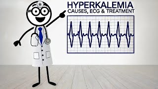 Hyperkalemia Explained Causes ECG Symptoms amp Treatment  ICU Essentials [upl. by Jeraldine]