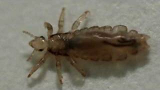 Head Lice Information for Parents [upl. by Nowujalo]