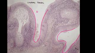 Histology of Palatine tonsil \Tonsil [upl. by Ytissac]