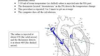 Thermodilution CO [upl. by Thordia]