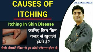 CAUSES OF ITCHING  Itching in skin diseases amp other causes  Differencial Diagnosis of itching [upl. by Naed]