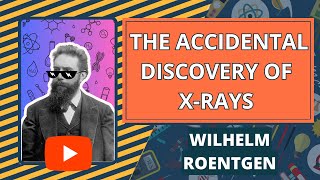 Wilhelm Roentgen The Accidental Discovery of Xrays wilhelmroentgen [upl. by Boice]