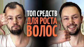 ТОП 5 средств для роста волос от врача дерматолога [upl. by Khosrow932]