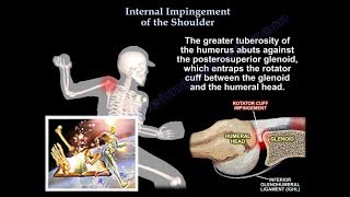 Internal Impingement of the shoulder Everything You Need To Know  Dr Nabil Ebraheim [upl. by Oranneg]