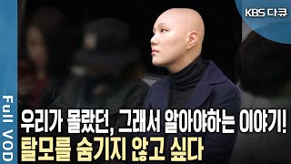 국민 5명 중 1명 탈모 인구 천만 시대 곱지 않은 시선과 편견과 맞서 오늘을 사는 전신 탈모인들  KBS 다큐 공감  힘내요 빛나는 그대  20180616 방송 [upl. by Dranik]