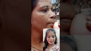 Pimple wali skin par makeup [upl. by Brook627]