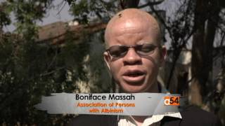 Intent for strict security for Albinos in Malawi [upl. by Quirita]